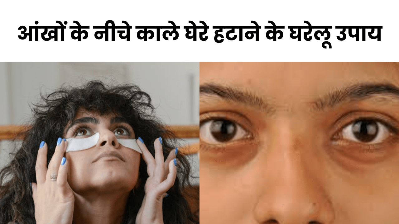 आंखों के नीचे काले घेरे हटाने के घरेलू उपाय: प्राकृतिक और प्रभावी तरीके